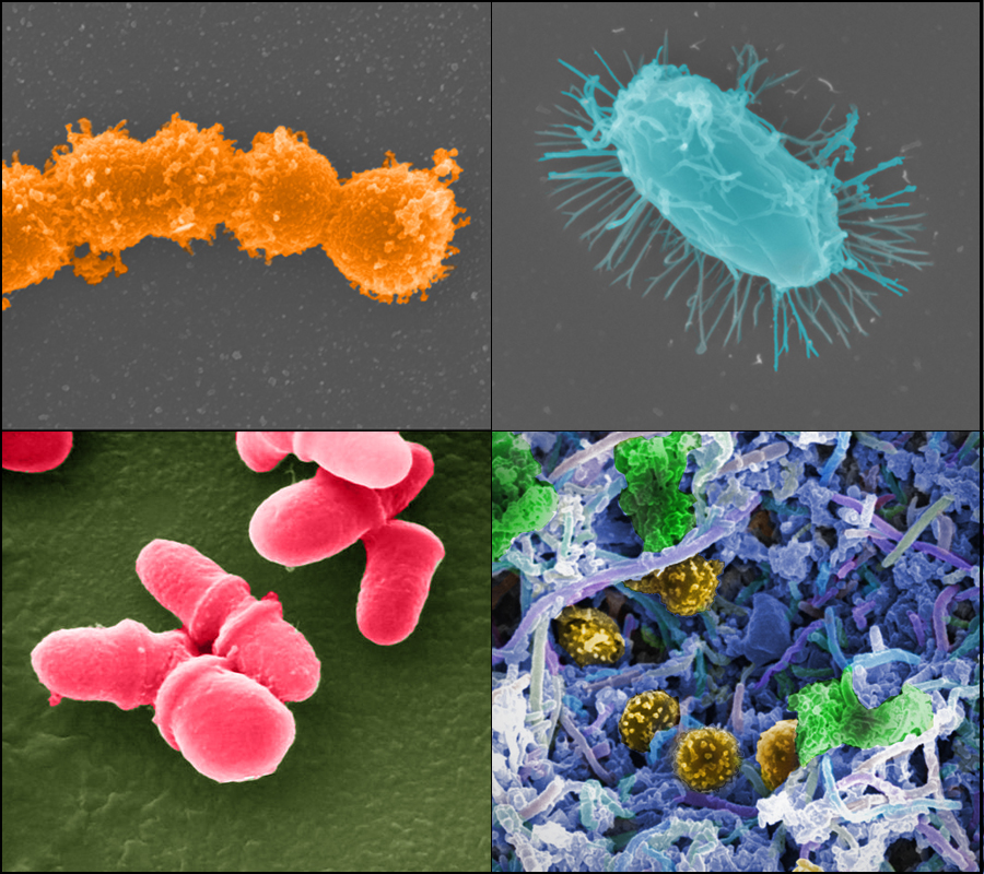 A picture of four different groups of microbes as if they were taken with a SEM microscope.